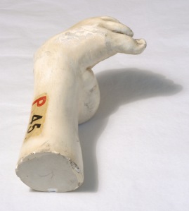 P.45 Plaster Cast Foot (Great Ormond Street Hospital), UCL Medical Collections